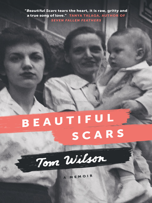 Title details for Beautiful Scars by Tom Wilson - Available